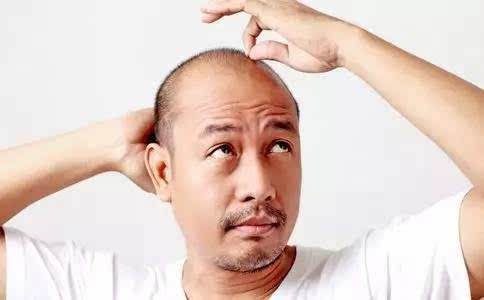 太原医院专家讲解导致人脱发的原因有哪些